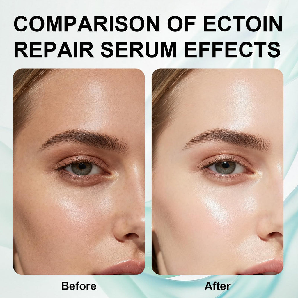 Nodfens Ectoin Face Serum, Adenosine Firming Serum for Smoothen Fine Lines & Strengthens Moisture Barrier, Oil-Free Anti-Aging Facial Serum for Targeted for Sensitive and Oily Skin - 1.01 fl oz