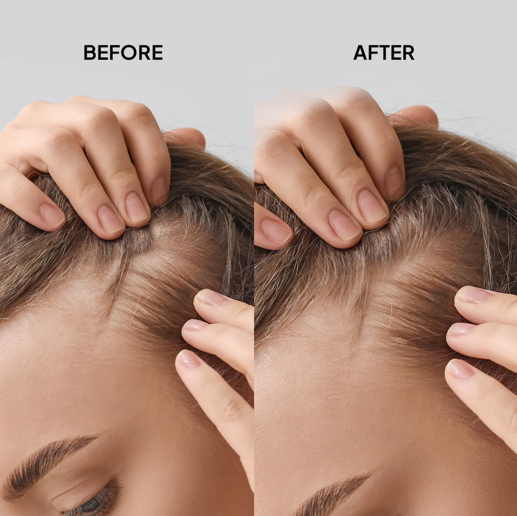 COBA’S DAUGHTER Redensyl Hair Growth Formula for Hair Loss | Hair Thickening scalp Refresher Spray | Biotin Hair Serum | Keratin, Chia Peptides | Fuller for Men and Women | Vegan (3.3oz)