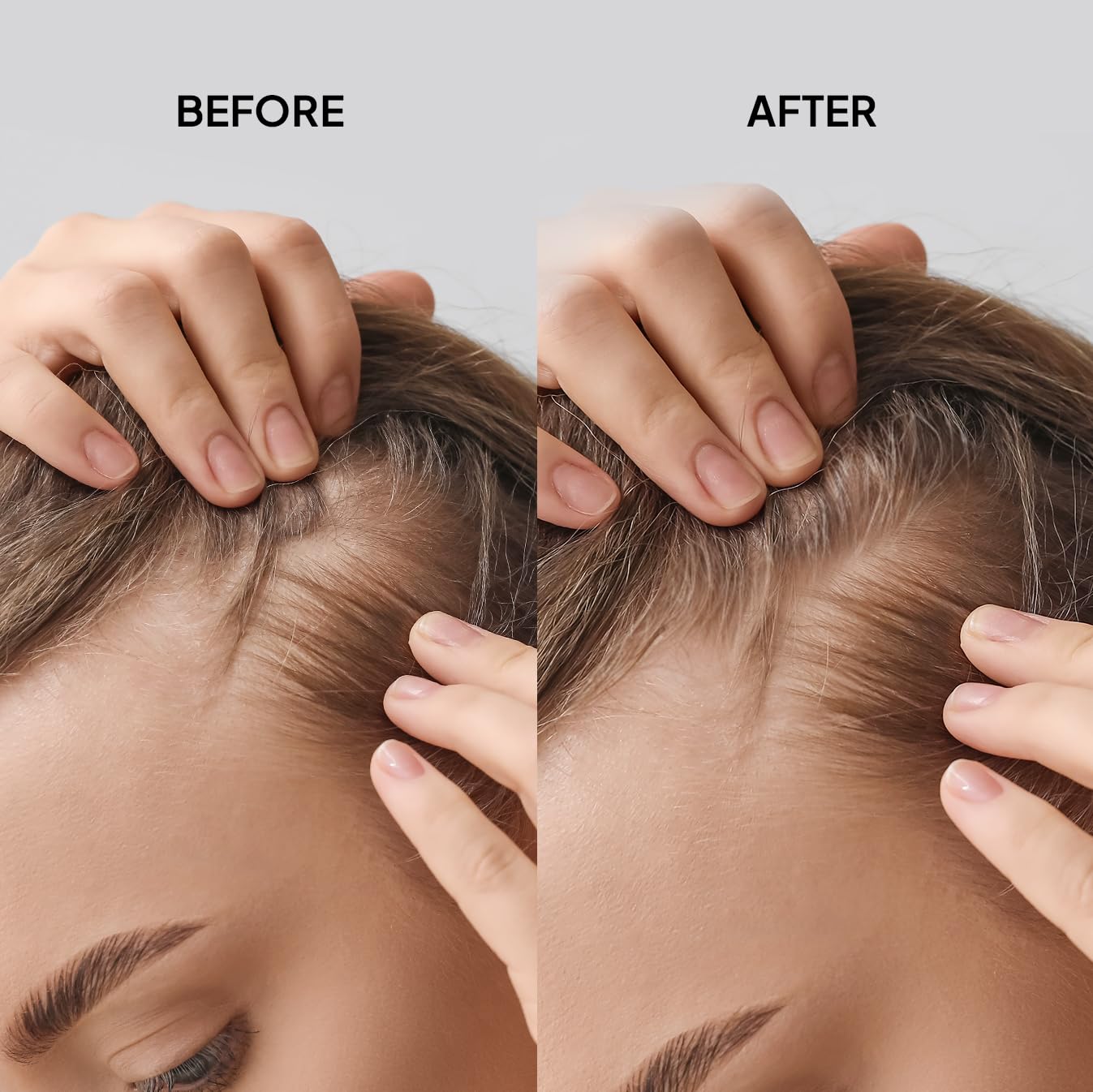 COBA’S DAUGHTER Redensyl Hair Growth Formula for Hair Loss | Hair Thickening scalp Refresher Spray | Biotin Hair Serum | Keratin, Chia Peptides | Fuller for Men and Women | Vegan (3.3oz)