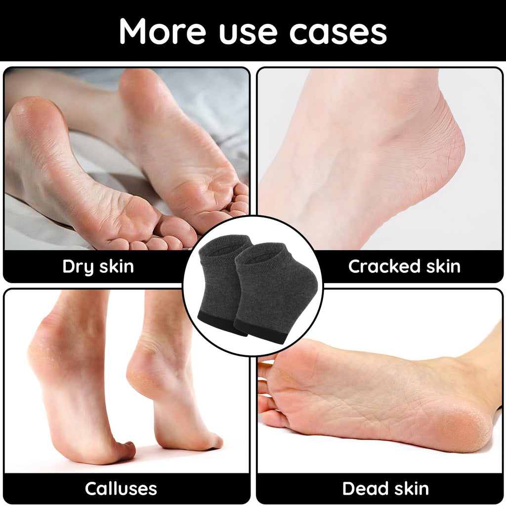 Segbeauty Feet Moisturizing Socks, 8 Counts Moisturizing Gel Heel Socks for Dry Cracked Heels, 4 Pairs Foot Care Moisture Socks for Dry Feet Overnight, Gel Lined Foot Moisturizing Open Toe Socks Black