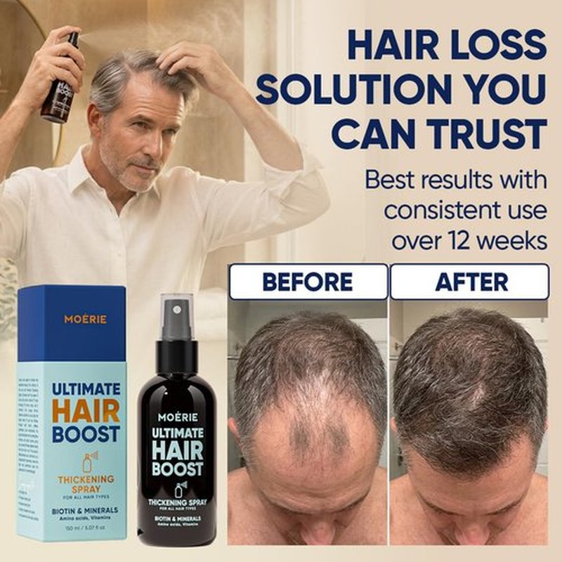 Moerie Hair Growth Serum Spray - Biotin & Rosemary Formula for Hair Regrowth | Unisex Thickening Solution