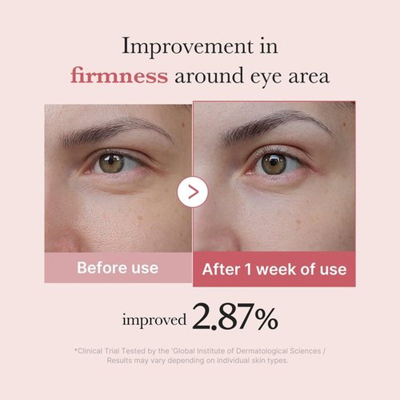 medicube Eye Serum with Salmon DNA PDRN & Pink Peptides | 99% Purity Retinol for Fine Lines | PDRN & Niacinamide for Uneven Skin Tone | Korean Skincare, 1.01 fl.oz