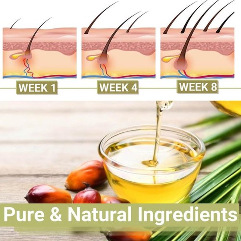 Minnah Hair Growth Oil, Extra Strength Rosemary Fenugreek Castor Oil, Natural Herbal Scalps Hair Care, Aceite de Romero para el Cabello (1 PCS)