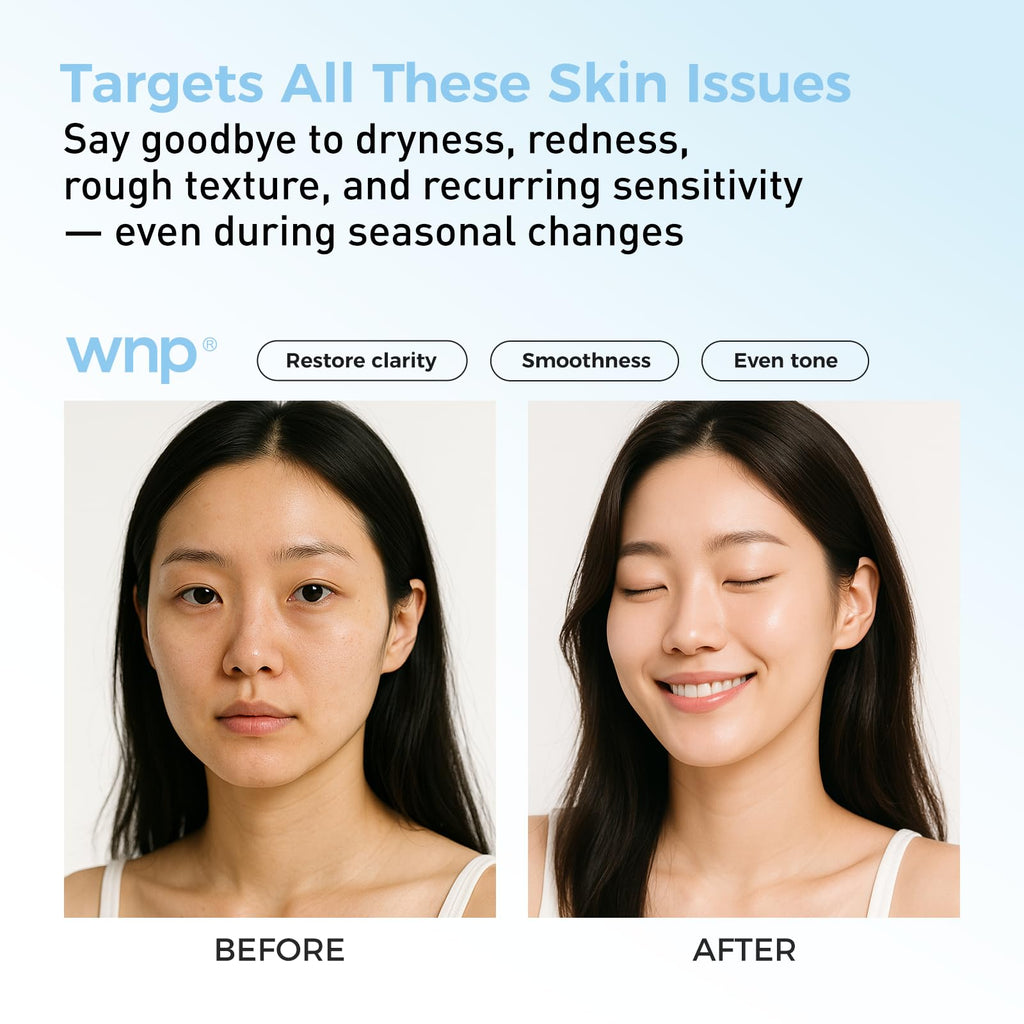 WNP Hyaluronic Acid Hydrating&Soothing Toner: 4D Hyaluronic Acid,Red Algae Extract,Bifida Ferment Lysate, Panthenol Deep Moisture&Skin Barrier Repair Vegan Skincare for Dry & Sensitive Skin