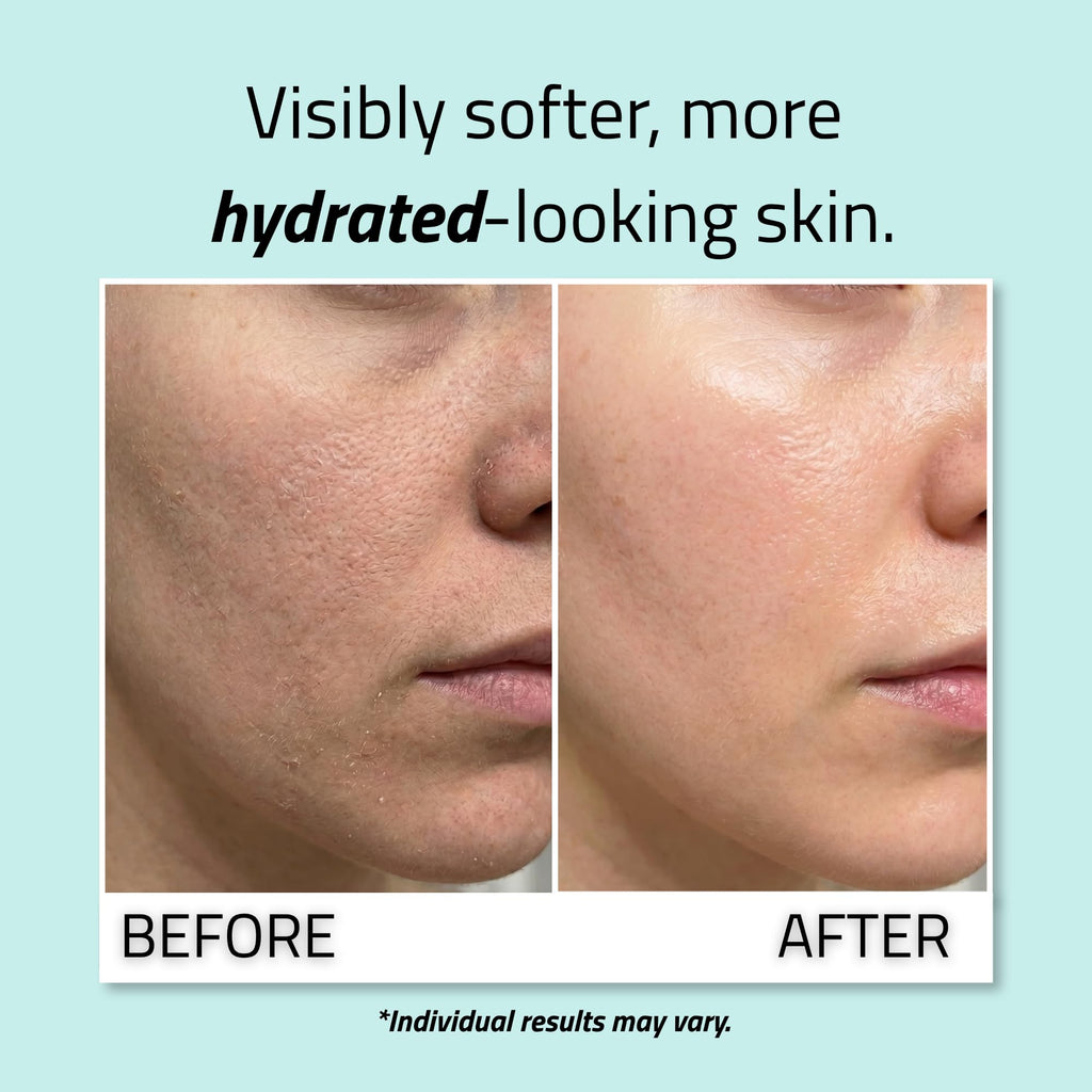 YEOUTH Pure Hyaluronic Acid Serum for Face with 99% Hyaluronic Acid, Plumping Hydrating Serum Targets the Appearance of Fine Lines, Dry and Dull Skin, 2 oz