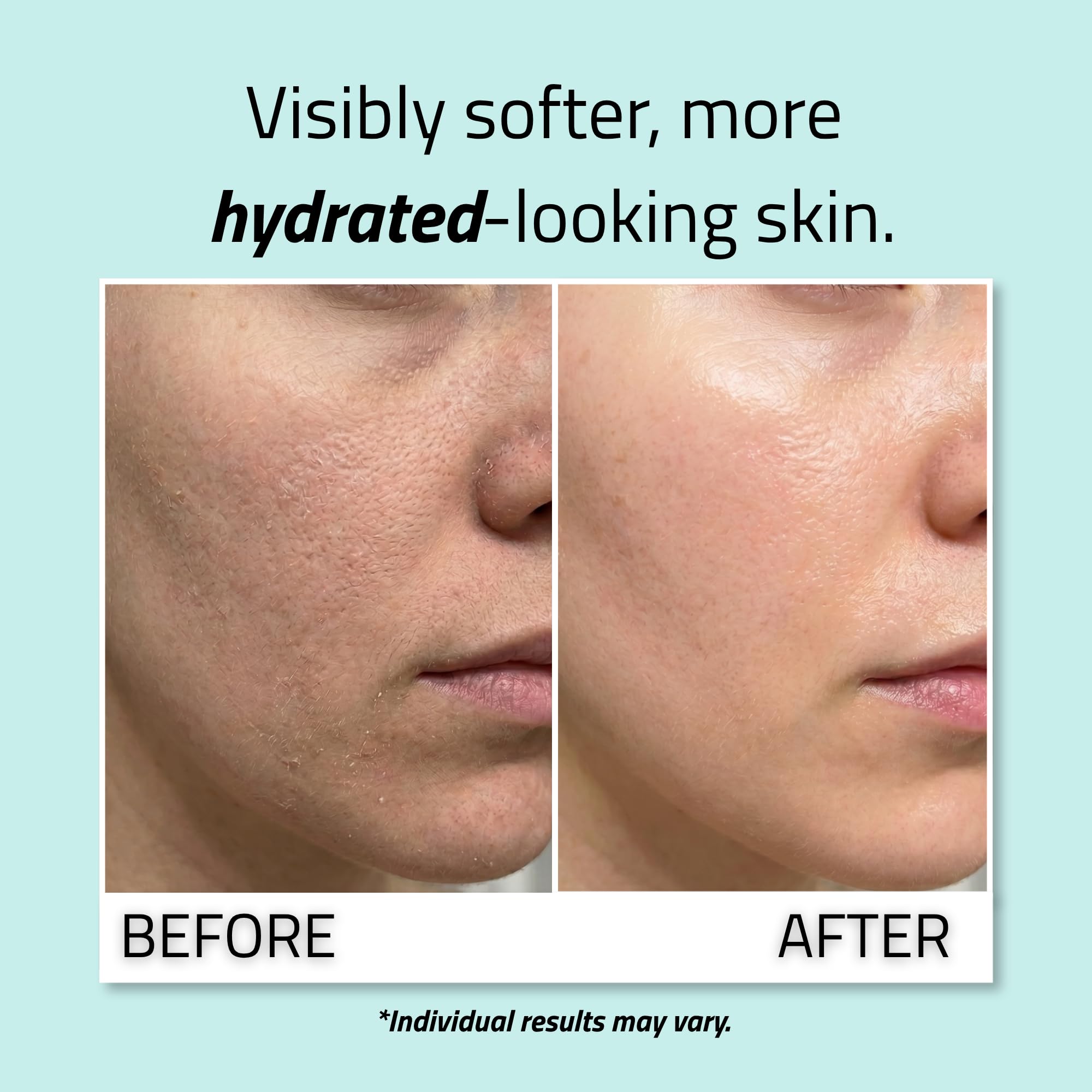 YEOUTH Pure Hyaluronic Acid Serum for Face with 99% Hyaluronic Acid, Plumping Hydrating Serum Targets the Appearance of Fine Lines, Dry and Dull Skin, 2 oz