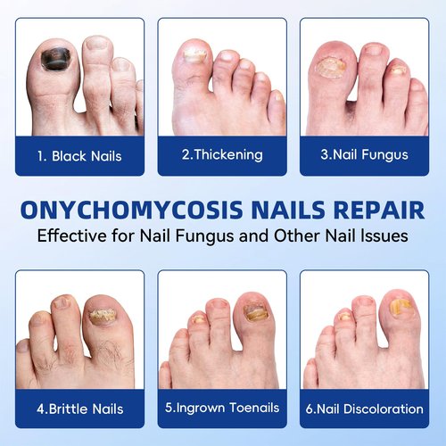 Fungal Nail Patches, Toenail Treatment Extra Strength, 8-Hour Overnight Nail Fast Acting Repair Effortless Hydrogel Nail Care and Repair for Damaged Nails Overnight Renewal 21 Patches
