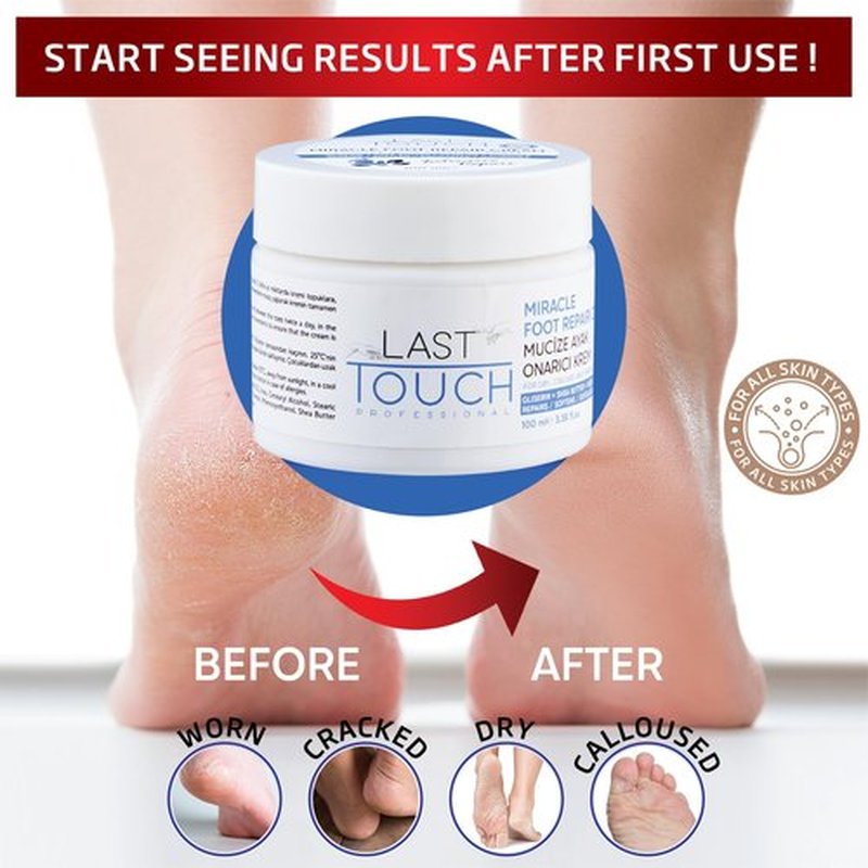 LAST TOUCH Miracle Cracked Repair Foot Care Cream - Foot Cream Dry Cracked Heels - Guaranteed Relief Worn, Cracked, Dry, Callused Feet - Athletes Foot Cream - Soft Smooth Feet 3.38 Fl Oz