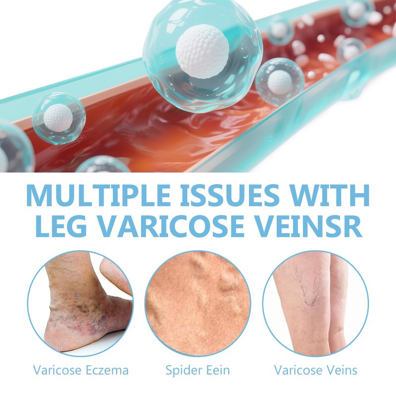 Varicose Veins Cream for Leg, Herbal Formula to Improve Skin Appearance & Smoothness, Ideal for Long-Standing Professionals