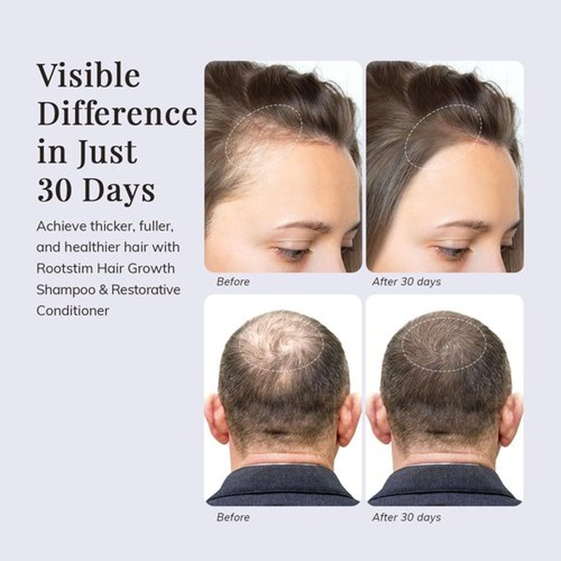 Skiennix Hair Growth Shampoo & Conditioner Set - Rosemary & Biotin for Thicker, Healthier Hair