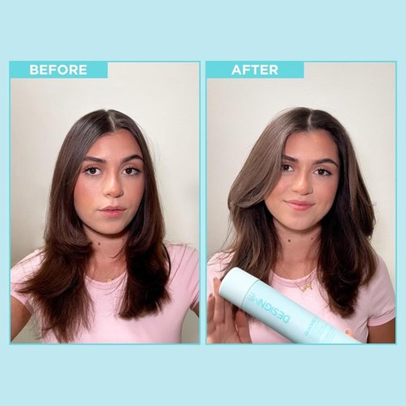 QUICKIE.ME Dry Shampoo Spray - Oil-Absorbing & Residue-Free Formula | Root-Lifting, Waterless 7 Oz