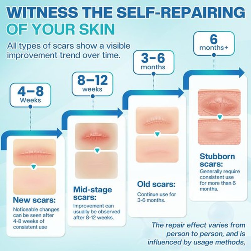 Advanced Silicone Scar Cream Gel Scar Removal for Old and New Treatment Remover Fading Surgical Face Burn C Section Heal Fast Acne Keloid for Men and Women Improve the Appearance 50g（1.76 Oz）/ 2 Pack
