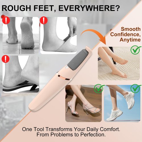 Electric Foot File, Callus Remover for Feet,Rechargeable Foot Pedicure Tool for Dry &Dead Cracked Skin,Professional Cordless Hard Skin Removal with 2 Durable Heads