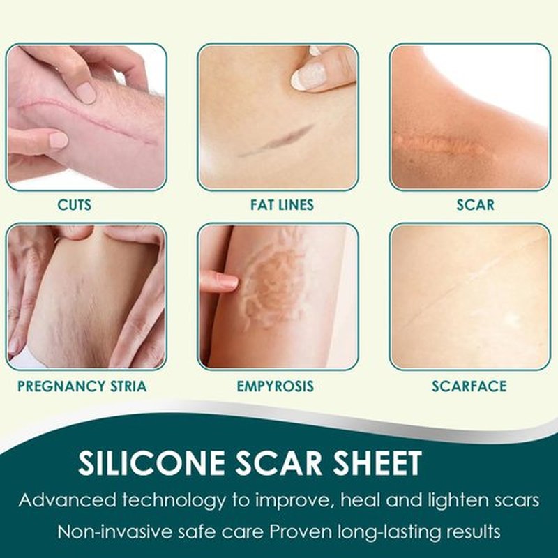 Silicone Scar Tape (1.6"x 120" Roll-3M), Premium Silicone Gel Scar Sheets, Reusable Silicone Patches, Soft Silicone Tape for Surgeries Scars, C-Sections, Wrinkles et