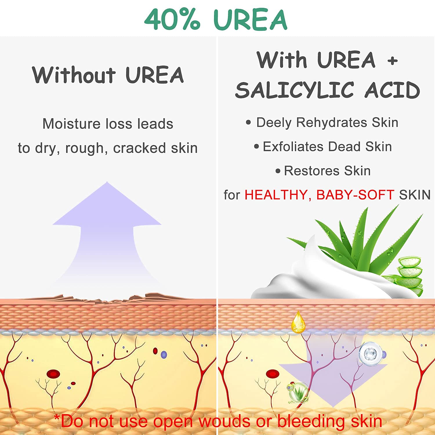 Urea Cream 40 Percent For Feet, Foot Cream, 40% Urea Lotion For Dry Skin/Cracked Heels/Ultra Calloused Feet, Softening Rough Skin On Feet, Skin Care with Glycerin, Jojoba for Men/Women, 4.3 oz