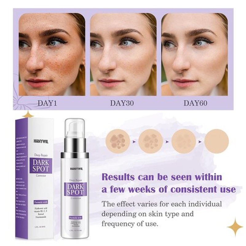 HANYWIL Dark Spot Remover Serum - Retinol & Niacinamide Formula for Melasma & Hyperpigmentation | 1.7 Fl Oz