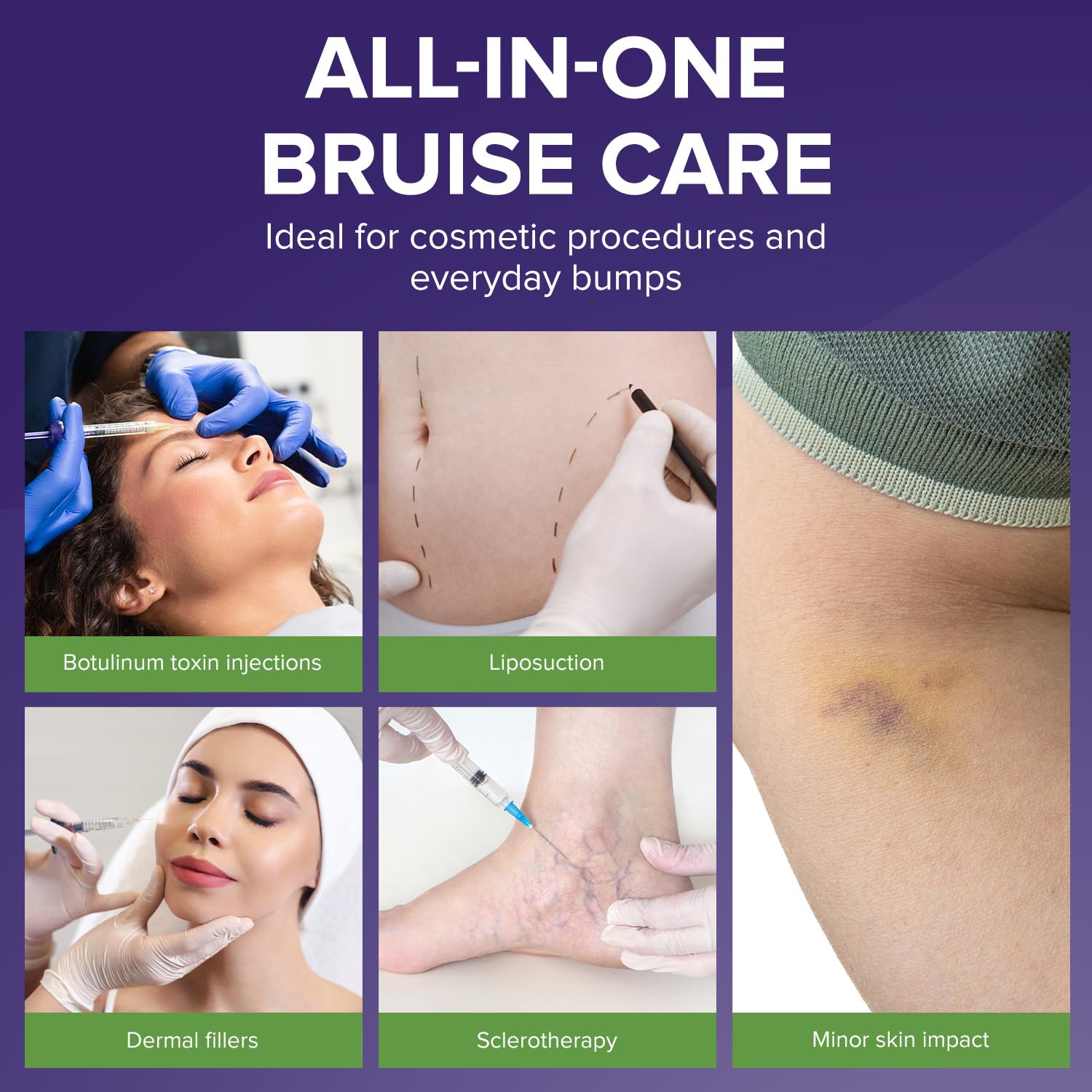 BIOCORNEUM Advanced Bruise Cream 1oz – Professional-Grade Arnica & Vitamin K Cream for Visible Skin Recovery – Botanical Formula with Vitamin E, Green Tea Extract & More – Lightweight, Fast-Absorbing