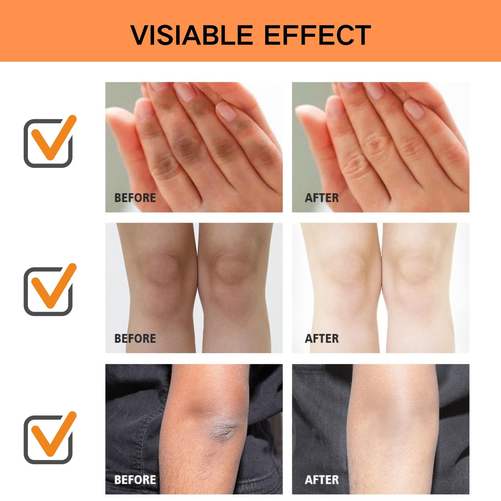 XYFSZDQJZHG Dark Knees and Elbow Remover, Underarm Cream Body Moisturizer Lotion, Dark Toe Knuckle Treatment Removal, Skin Cream for Armpit Inner Thigh Neck Private Part Intimate Legs (120g)