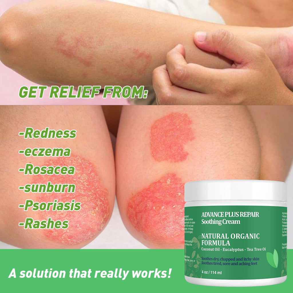 KOKOMAANE Tea Tree Oil and Manuka Honey Balm, Double Add, Jock Itch Cream Extra Strength, Natural moisturiser, Dyshidrotic Eczema Ointment, Relieves itching, Smoothes dry & sensitive skin