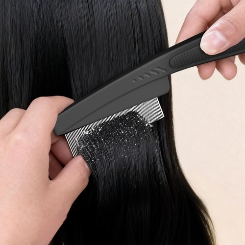 Dandruff Comb | Fine Tooth Stainless Steel Scalp Detox Tool for Lice Removal - Black & Orange