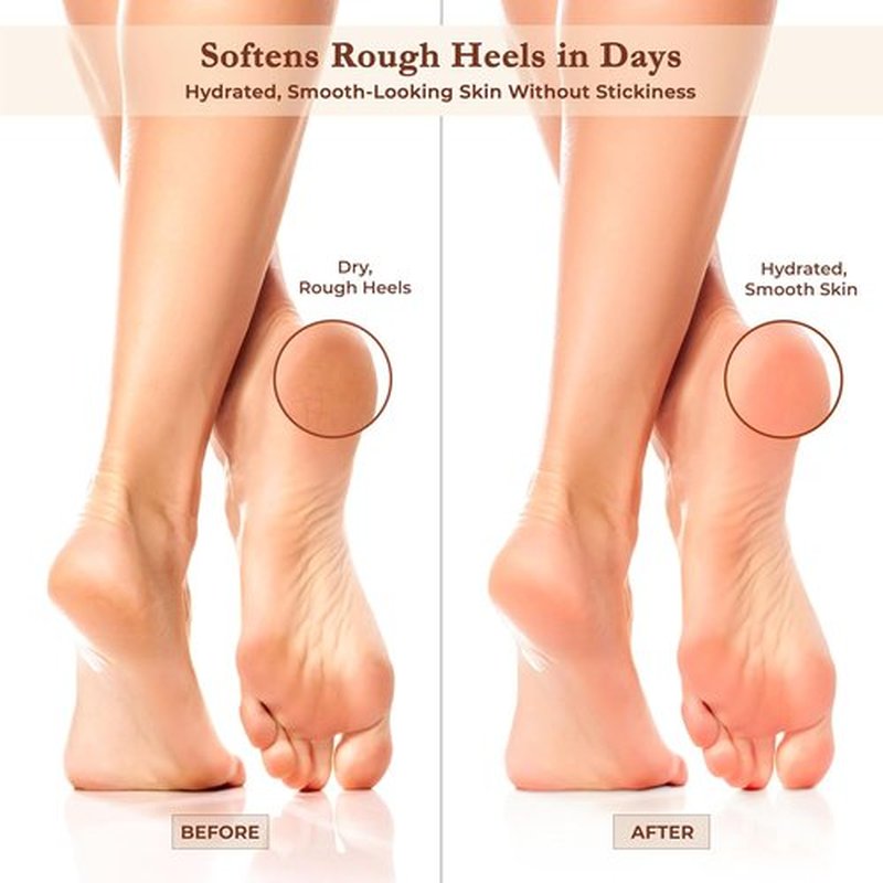 Regine Switzerland Foot Cream - Hydrating Moisturizer with Argan Oil & Shea Butter for Dry Cracked Heels | Fast-Absorbing, Non-Sticky Care