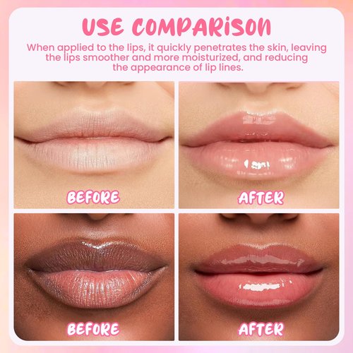 TEIHWAL 4PCS Bee Lip Balm Honey Pot Cherry Watermelon Coconut Honey Lip Balm, Moisturizing Sleeping Lip Mask Overnight, Prevention Dry and Cracked Lips