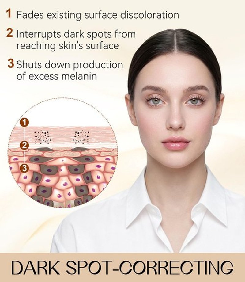 Dark Spot Remover for Face & Body, Dark Spot Corrector with Niacinamide, Fade Cream for Hyperpigmentation, Sun Spots, Age Spots & Melasma, 1.7 fl oz, Skincare Gift for Women, Mother’s Day Gift