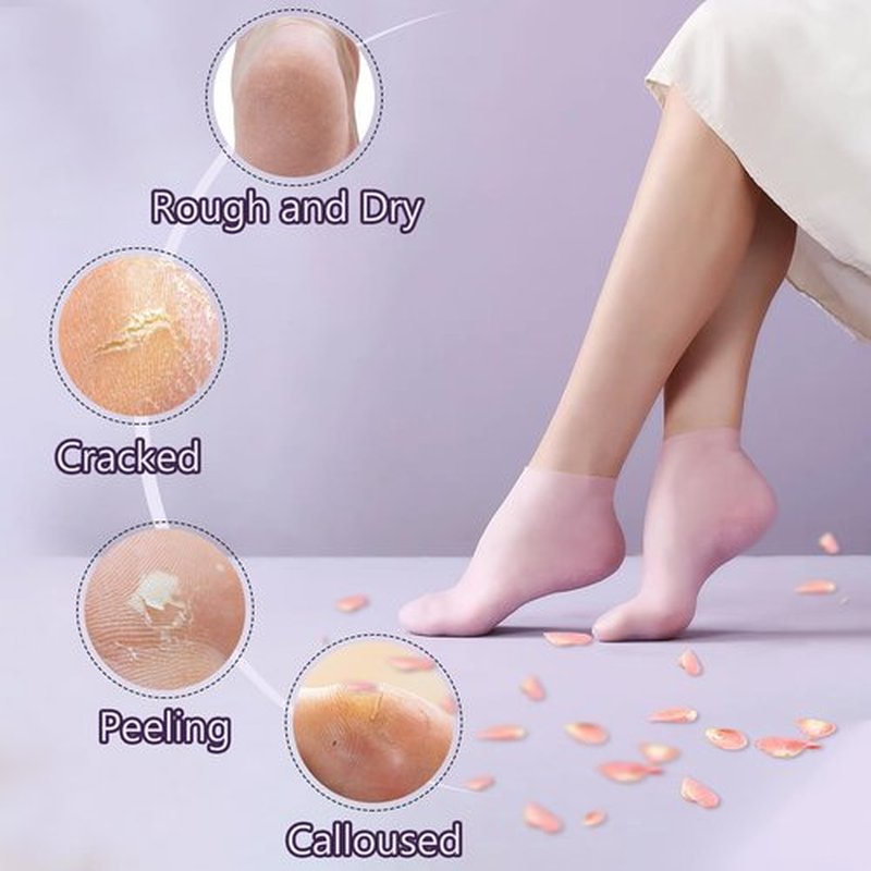 TEAWOO 5 Pairs Moisturizing Socks (2 Silicone Socks & 3 Heel Socks) for Dry Cracked Feet, Spa Gel Socks Foot Care After Pedicure, Toeless Socks to Soften and Hydrate Feet Heels