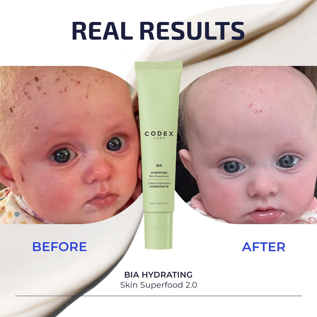 Superfood Moisturizer for Dry Skin by Codex Labs