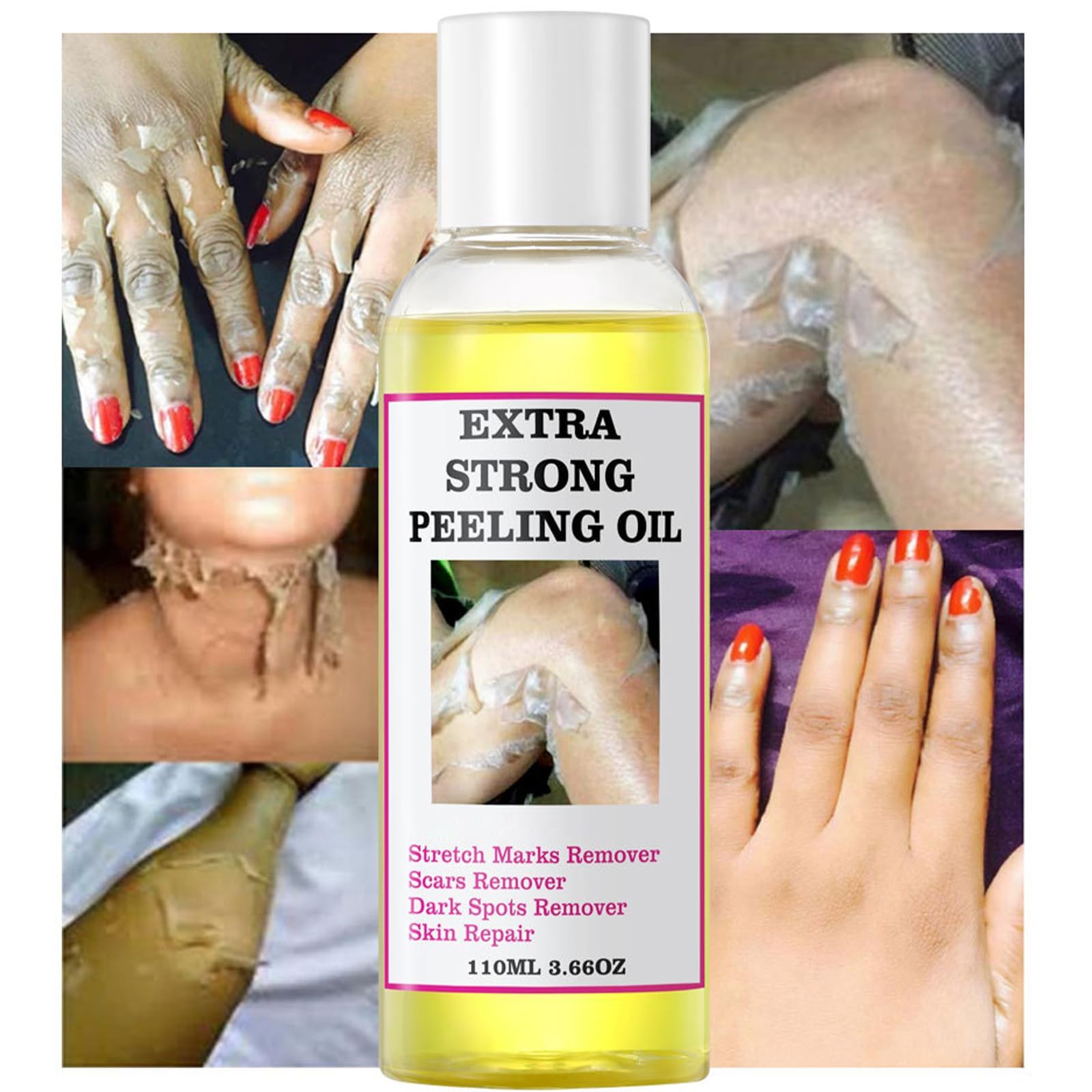 Generic Extra Strong Yellow Peeling Oil for Dark Skin - Exfoliating Solution for Body, Hand, Feet and Face - All Skin Types (110ML/3.88 Fl Oz)