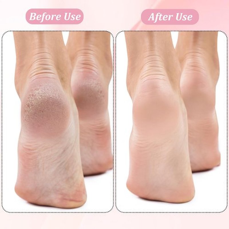 FWUNYVN 13 Pcs Replacement Roller Heads for Flawless Pedi, Suit for Finishing Touches Flawless Pedi Electric Foot File, 6 Pcs Black Coarse＆3 Pcs Gray Fine＆3 Pcs Pink Fine,1 Pc Cleaning Brush