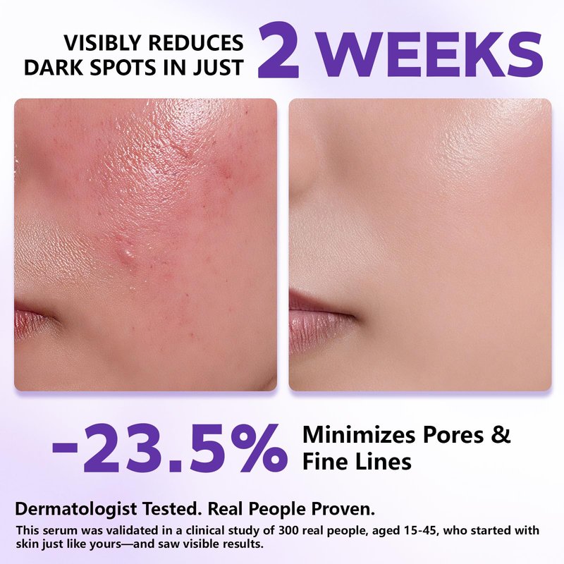YUFUY 14% Tranexamic Acid Niacinamide Serum 30ML, Korean Facial Glass Skin Care Centella Serum Dark Spot Corrector Cream, Reduces Pigmentation Uneven Skin Tone, Pore Care for Sensitive Skin 1.01 FL.OZ