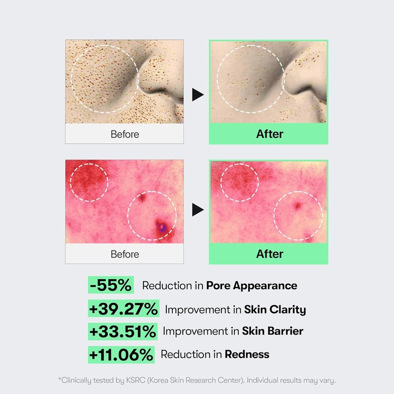 VT COSMETICS CICA Reedle Shot Serum - Spicule Microneedling for Pore Care & Exfoliation | 1.69 Fl Oz