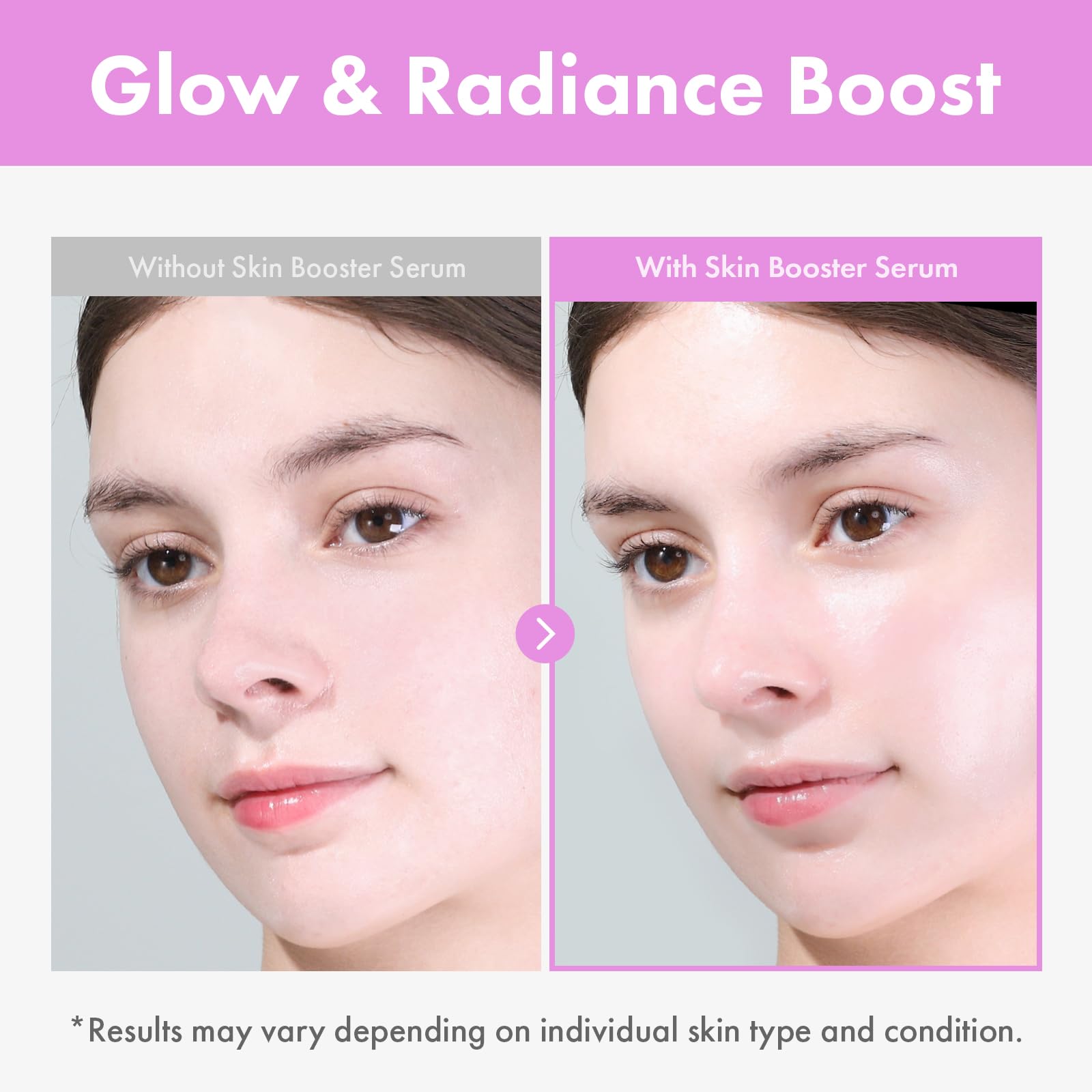 TOSOWOONG 9 Peptide Skin Booster Serum, Niacinamide & Hyaluronic Acid Skin Renewal Boosting Facial Essence for All Skin Types, Korean Skin Care, Paraben Free, 150ml, 5.07 fl.oz.