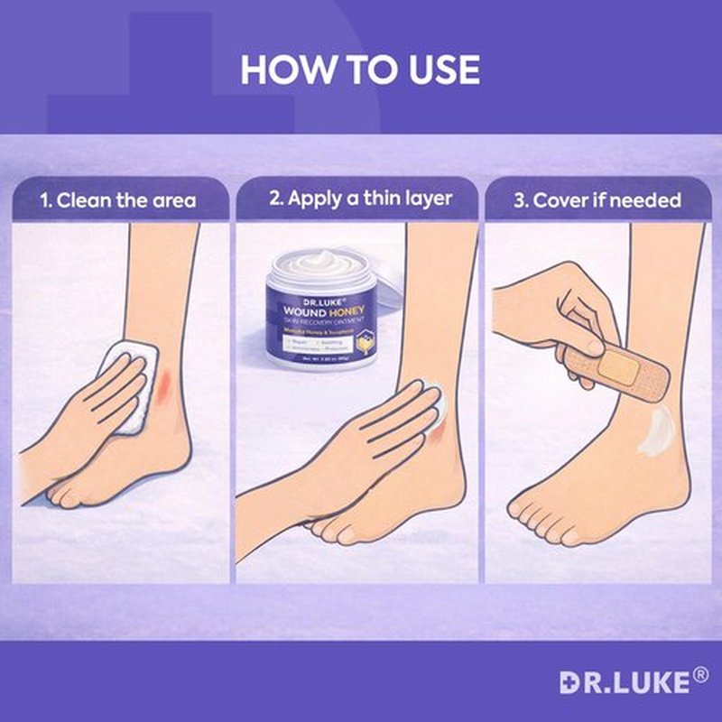 Dr. Luke Manuka Honey Wound Care: Medihoney Wound Gel for Minor wounds & Skin Repair - Manuka Honey Medical Grade with Akkantoin 0.5% & Vitamin E - 2.82 oz (80g)