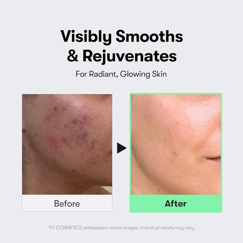 VT COSMETICS CICA Reedle Shot Serum - Spicule Microneedling for Pore Care & Exfoliation | 1.69 Fl Oz