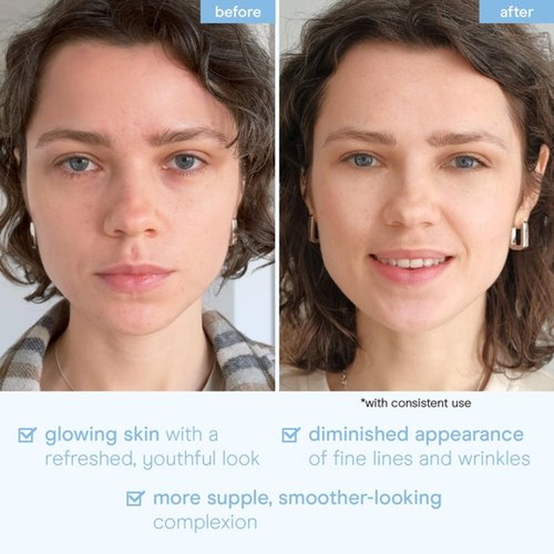 Baebody Advanced Snail Mucin Under Eye Patches for Women & Men - Under Eye Masks for Dark Circles and Puffiness - With Niacinamide - Reduce Fine Lines and Wrinkles (Snail Mucin Face Mask)