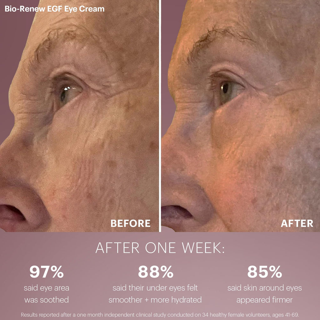 Glo Skin Beauty Bio-Renew EGF Discovery Set ($196 Value) – Travel Size Anti-Aging Skincare Kit for Hydration, Smoothing & Skin Renewal