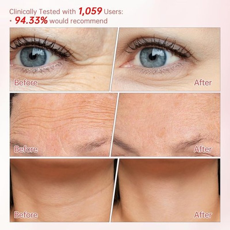 Peunitory Eye Balm Stick - Anti-Wrinkle Firming Treatment | Dark Circle Brightener | Hydrating 0.32oz