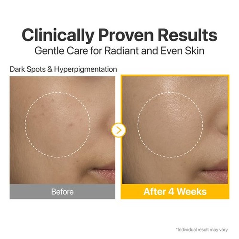 Numbuzin No.5 Vitamin Serum - Dark Spot Care with Glutathione & Niacinamide | 1.01 fl oz for Radiant Glow