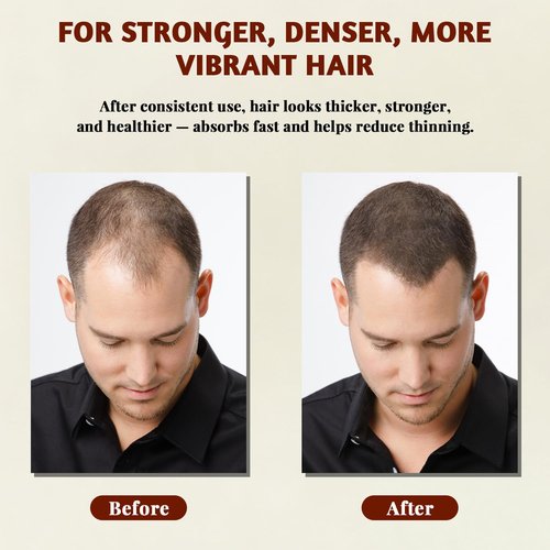 Batana Oil for Hair Growth – Natural & Pure Hair Oil, Prevents Hair Loss, Enhances Thickness, Restores Smoothness with Biotin, for Men & Women, Suitable for Curly & Straight Hair 4.23 oz