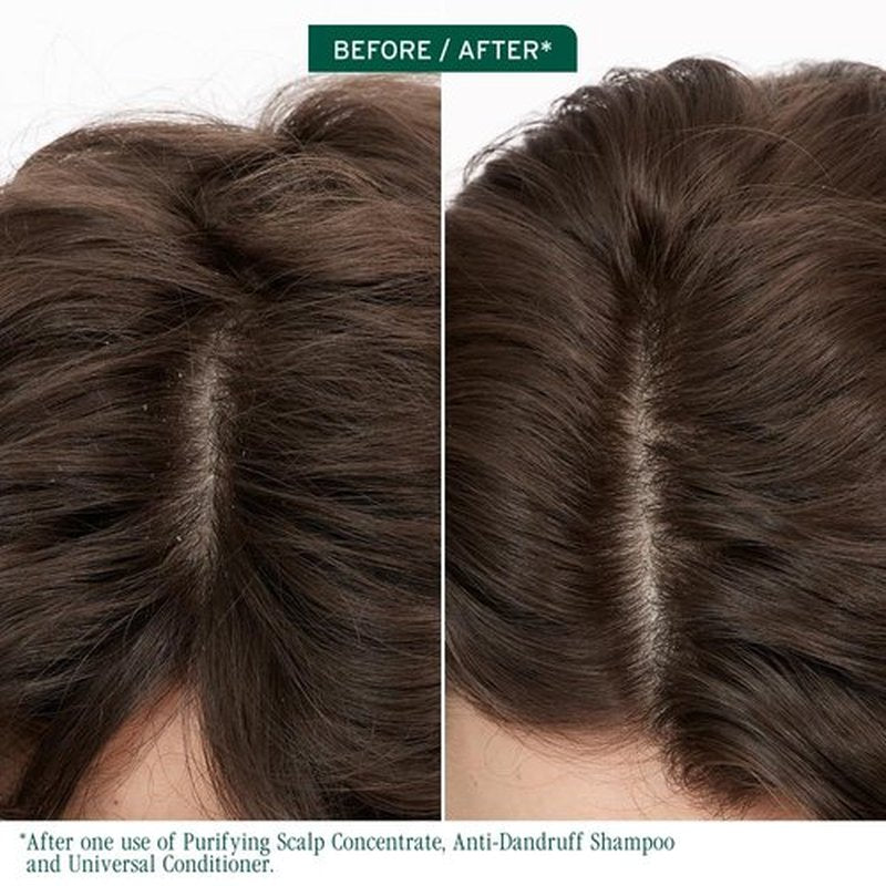 Biolage Scalp Sync Purifying Concentrate - Exfoliating Dry Scalp Treatment with Fermented Tea & Glycolic Acid
