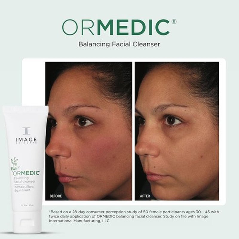 IMAGE Skincare ORMEDIC pH Balancing Facial Cleanser - Mild Foaming & Hydrating Face Wash with Aloe Vera | 1.7 fl oz