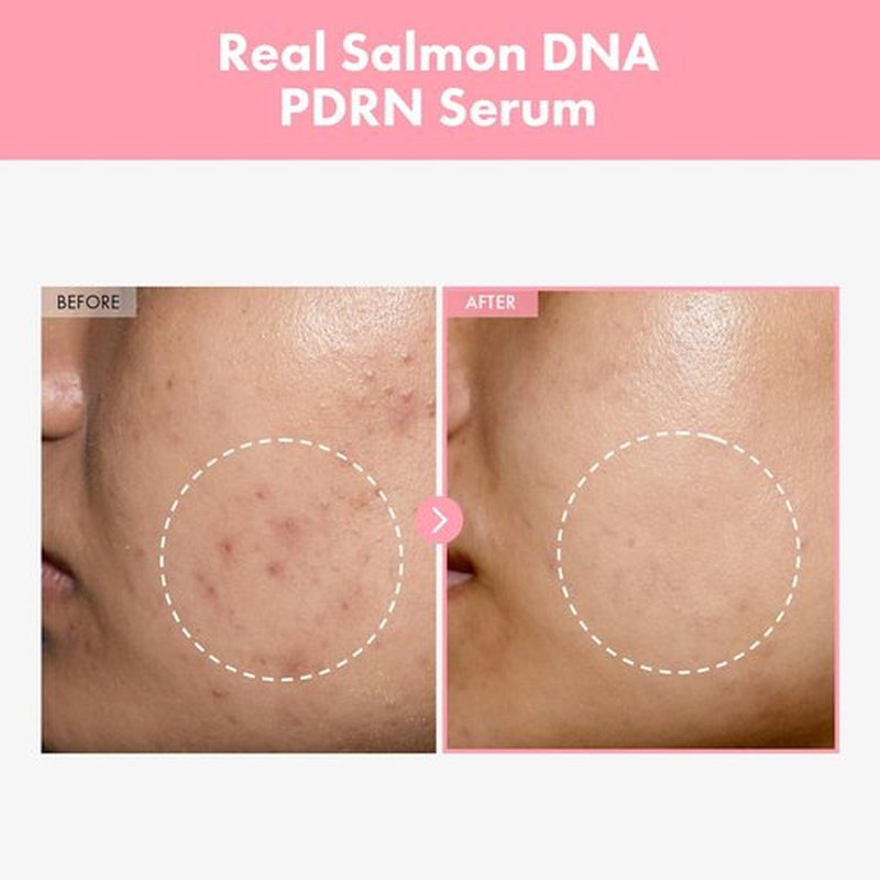 TOSOWOONG Pink Peptide 12 PDRN Serum With Salmon DNA PDRN 10,320ppm, 12 Peptides, Niacinamide, Skin glow, Hydrating, Moisturizing, Firming, Uneven Skin Tone, Korean Skincare, 33ml, 1.11 fl.oz.