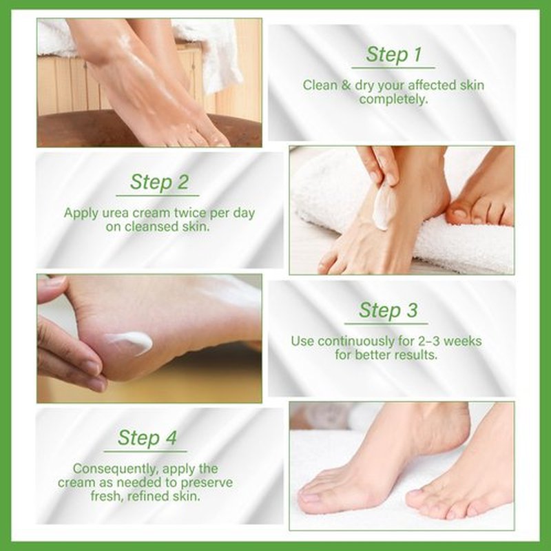 AOPEIBOTO Urea Cream 60 Percent for Feet Maximum Strength, Foot Cream for Dry Cracked Heels and Feet, Foot Moisturizer, 5.29oz/150g