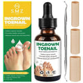 Ingrown Toenail Treatment: Ingrown Toenail Removal Kit - Ingrown Toenail Tool for Men Women - Ingrown Toenail Corrector Drops - Ingrown Toenail Remover - Effective Solution for Ingrown Toenails - 30ml