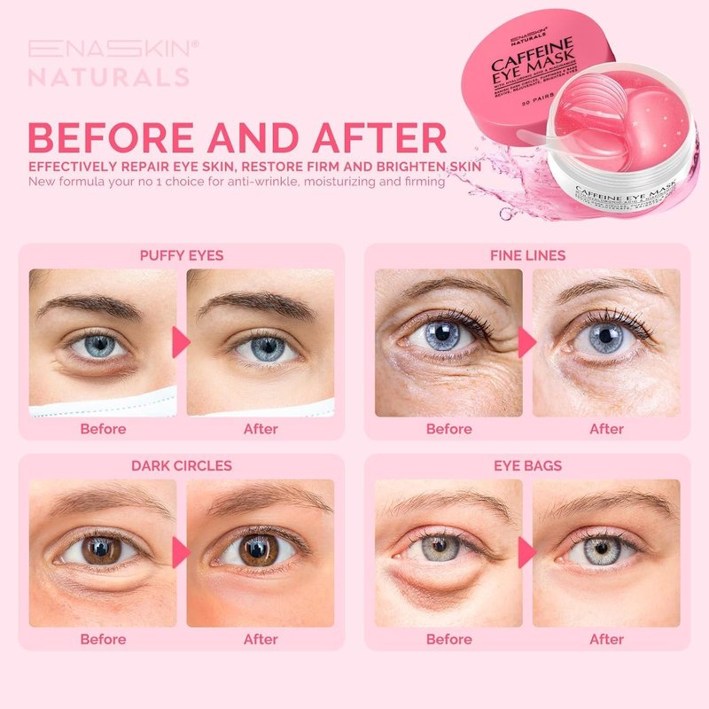Under Eye Patches for Puffiness and Dark Circles: Caffeine Gel Masks for Undereye Wrinkles Bags - Instant Moisturizing Brightening Skincare Pads - Gift for Women Mom Wife - 30 Pairs (Rose)