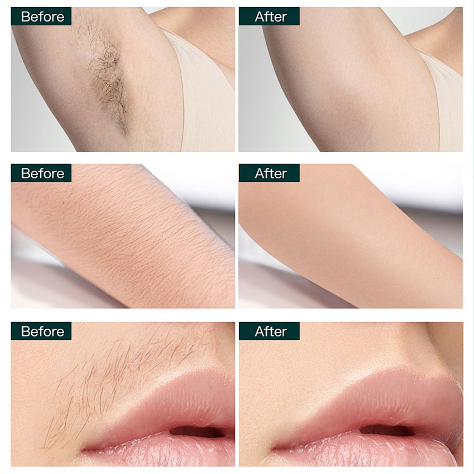 Bloomly Pro Facial Hair Remover, Gentle Micro-Trimming with Led Light, Portable Design, Painless Electric Face Razor for Coarse Hair (Skin Tone)