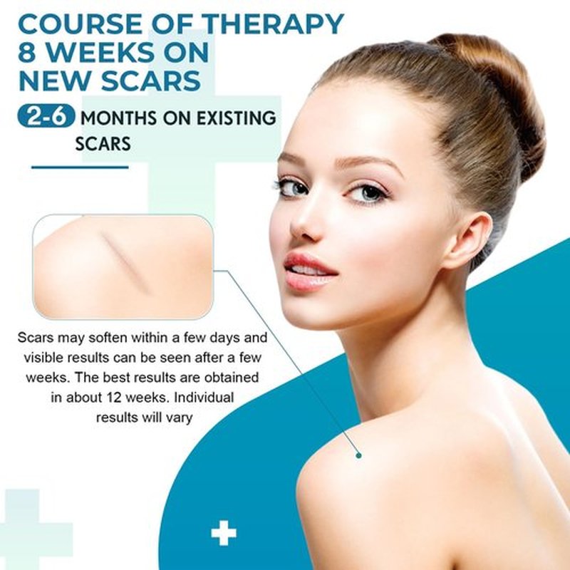 Silicone Scar Sheets, Silicone Scar Tape(1.6”x 120” Roll-3M), Silicone Scar Strips, Professional Scar Removal Sheets for Surgical Scars, Keloid, C-Section, Burn et