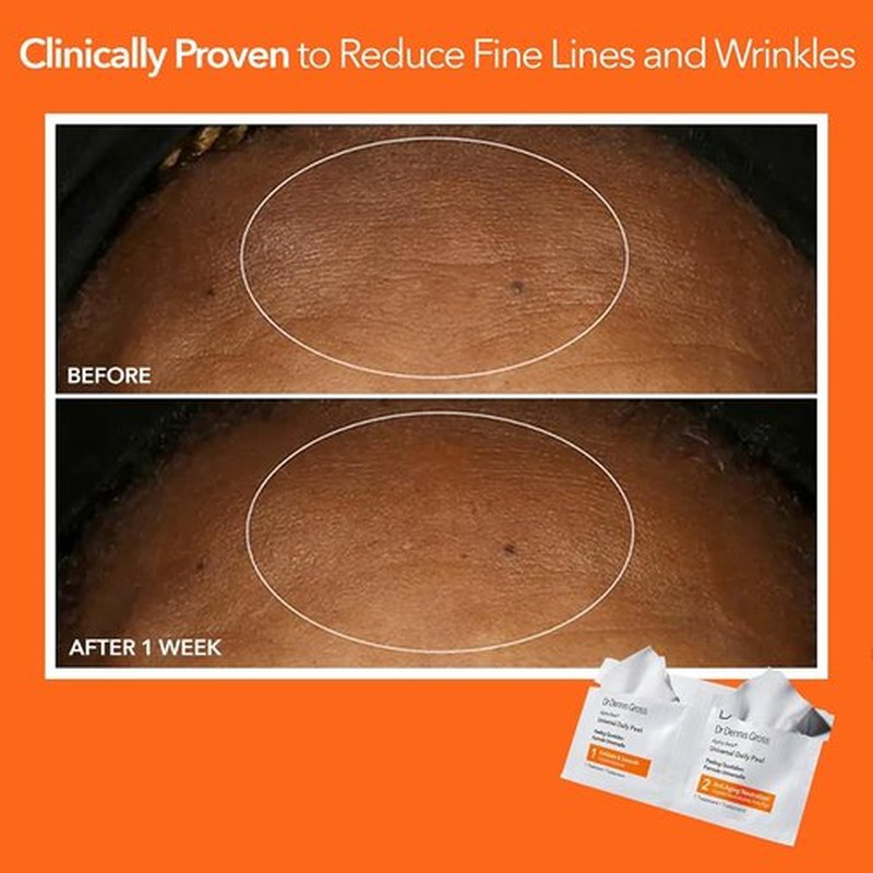 Dr. Dennis Gross Alpha Beta Daily Peel - Smooth Uneven Tone & Texture | 60 Treatments